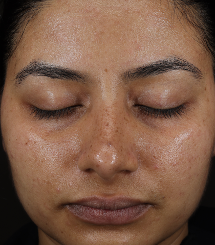 after treatment image
